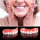 Proteza Dentara Superioara Temporara